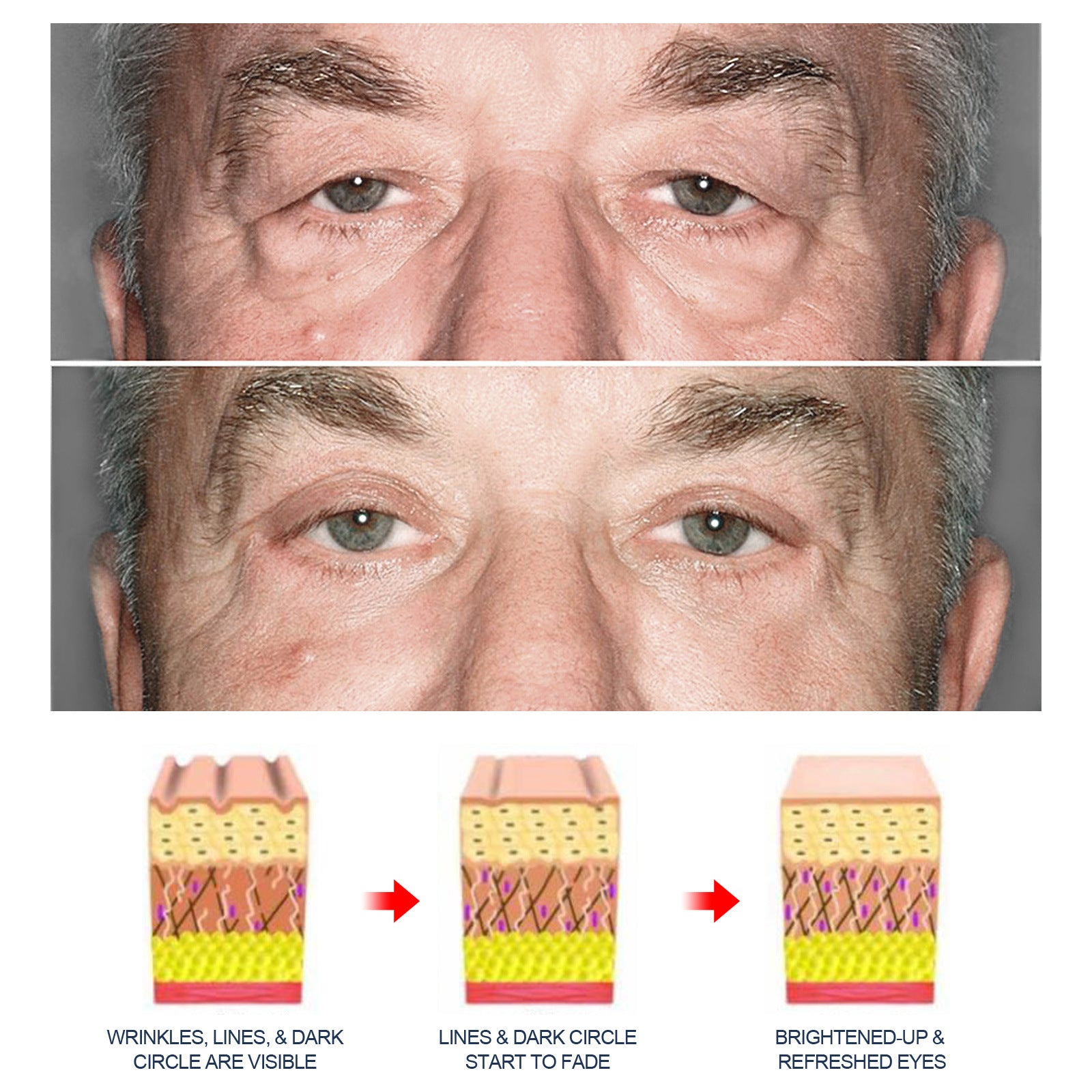 Crème anti-âge pour les yeux des hommes